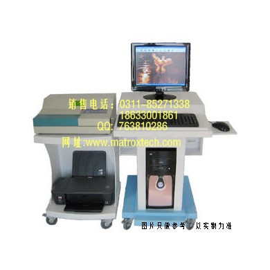 输卵管通液仪输卵管通液仪价格输卵管通液仪造影经济型
