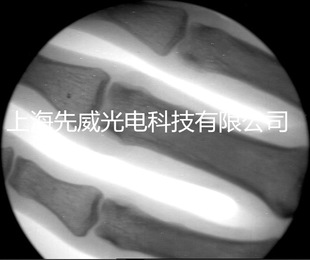 便携式x光机透视仪/诊断骨科设备/移动式x射线机/0.5毫安手提式