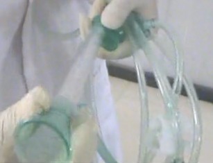 外科手术室冲洗器,术中冲洗,盈诺器械厂家