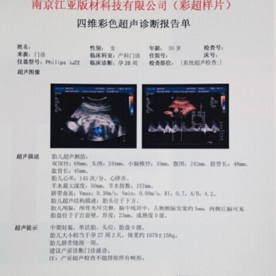 医用打印胶片