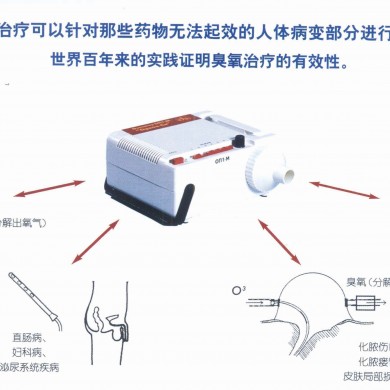 “猎户座—西”便携式臭氧治疗仪