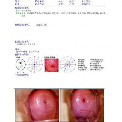 MPET新型B超胶片