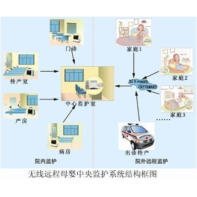 母婴监护仪