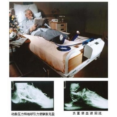 动静脉足底泵