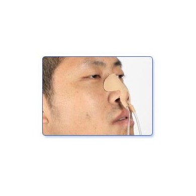 导管固定装置