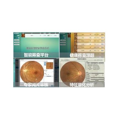 眼底影像慢病智能筛查平台