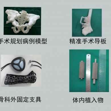 3D打印病例模型，手术导板，外固定支具，手术植入物