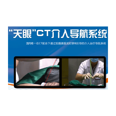 “天眼”CT介入导航系统