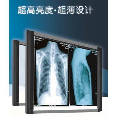 X射线胶片观片灯