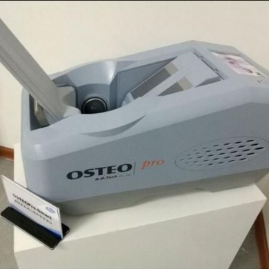 (产品招商)超声波骨密度仪_简介