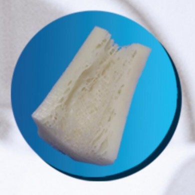 (产品招商)单面皮质骨板_简介