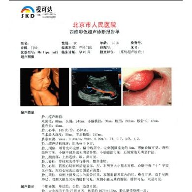 超声干式胶片_简介
