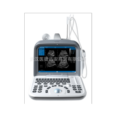 中旗ZQ-6600全数字超声诊断系统_简介