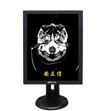 灰阶医用显示器_简介