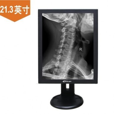 进口CT/进口乳腺设备用5兆灰阶屏_简介
