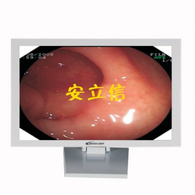 医用监视器_简介