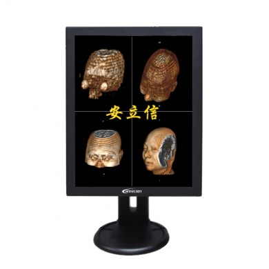 远程会诊显示器/山东省远程医疗_简介