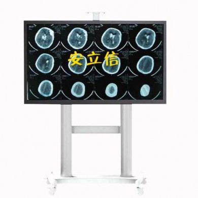 65寸8M远程会诊大屏显示器/8兆_简介