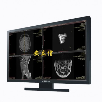 27寸4兆灰阶医用显示器/一体双屏_简介