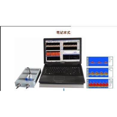 超声经颅多普勒血流分析仪_简介