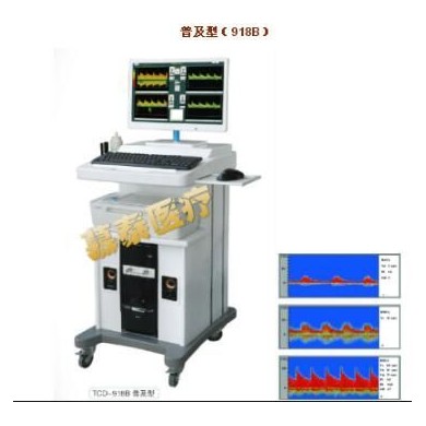 超声经颅多普勒血流分析仪（TCD-918B 普及型）_简介