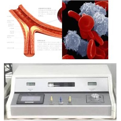 众满Zonma2000高能活氧免疫治疗系统_简介