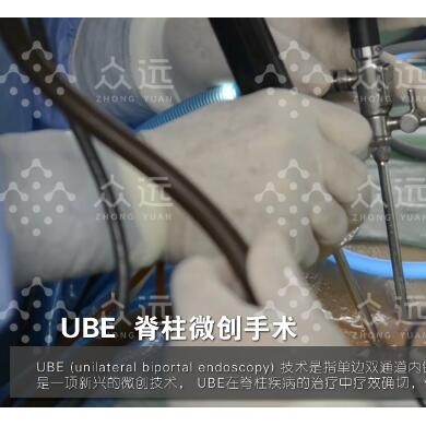 供应  UBE耗材，UBE电极，_简介