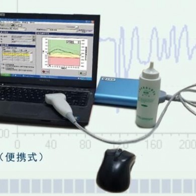 超声骨密度仪_简介