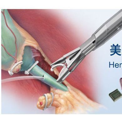 结扎锁Hem-o-lok_简介