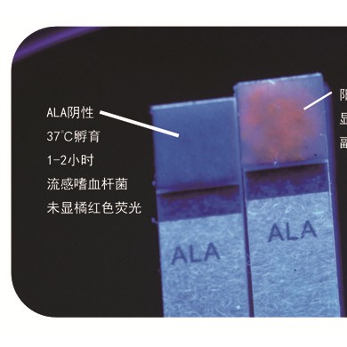 革兰阴性杆菌鉴定试剂（卟啉合成试验试剂）_简介