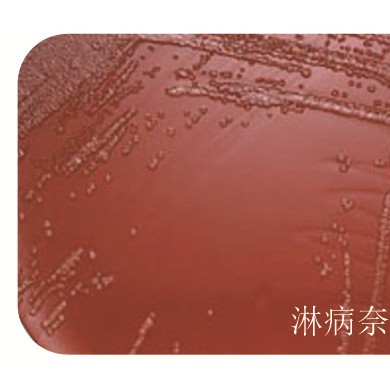 TM淋病奈瑟菌培养基_简介