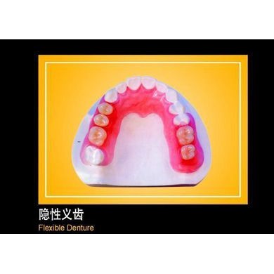 隐性义齿_简介