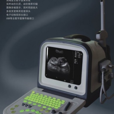 全数字B超HY5511_简介