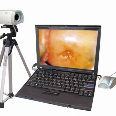 PL-9800 便携式电子阴道镜_简介