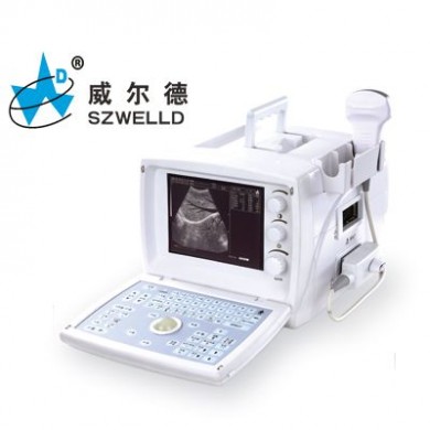 B型超声诊断仪_简介