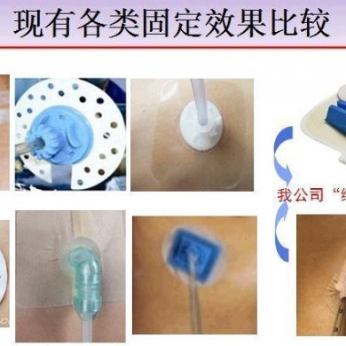 引流管固定器_简介