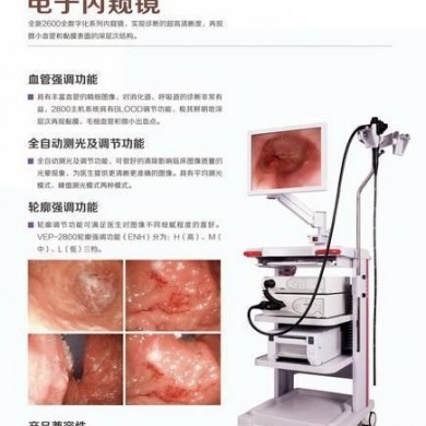 电子支气管镜_简介