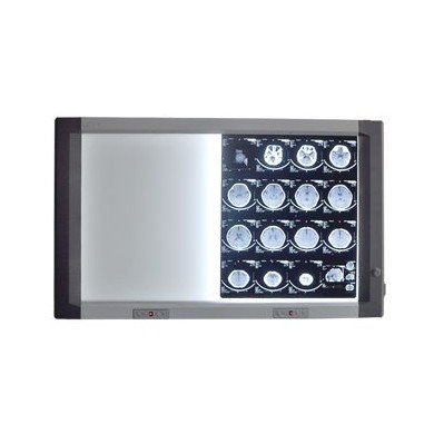 led医用双联观片灯_简介