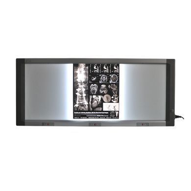 医用led三联观片灯_简介