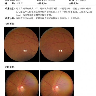 泰瑞眼科医生版（图像管理图文报告套件）_简介