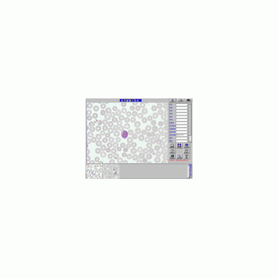 TCT液基细胞检测系统_简介