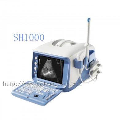 SH1000 B型超声诊断仪_简介