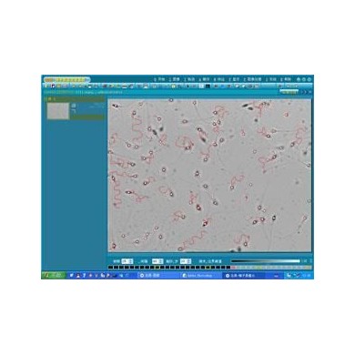 精子质量分析软件_简介