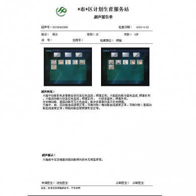 超声工作站_简介