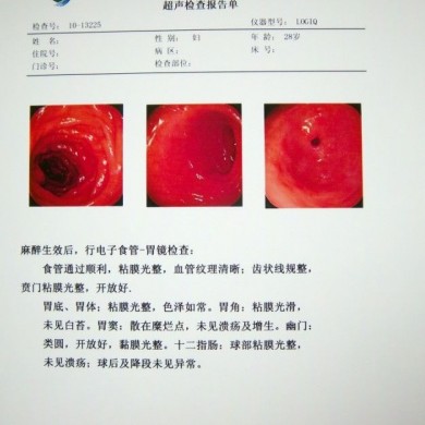 激光胶片_简介