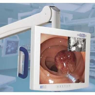 NDS监视器19寸，24寸_简介