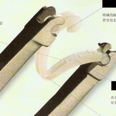 威克结扎锁，史托斯电切环_简介