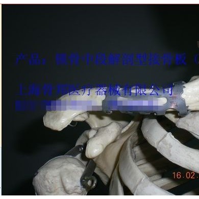 3.记忆合金锁骨中端接骨板_简介