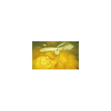 新型脑绵片_简介