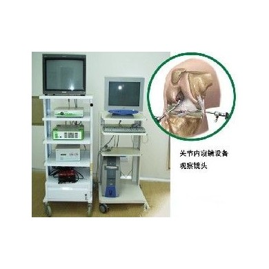 关节镜_简介